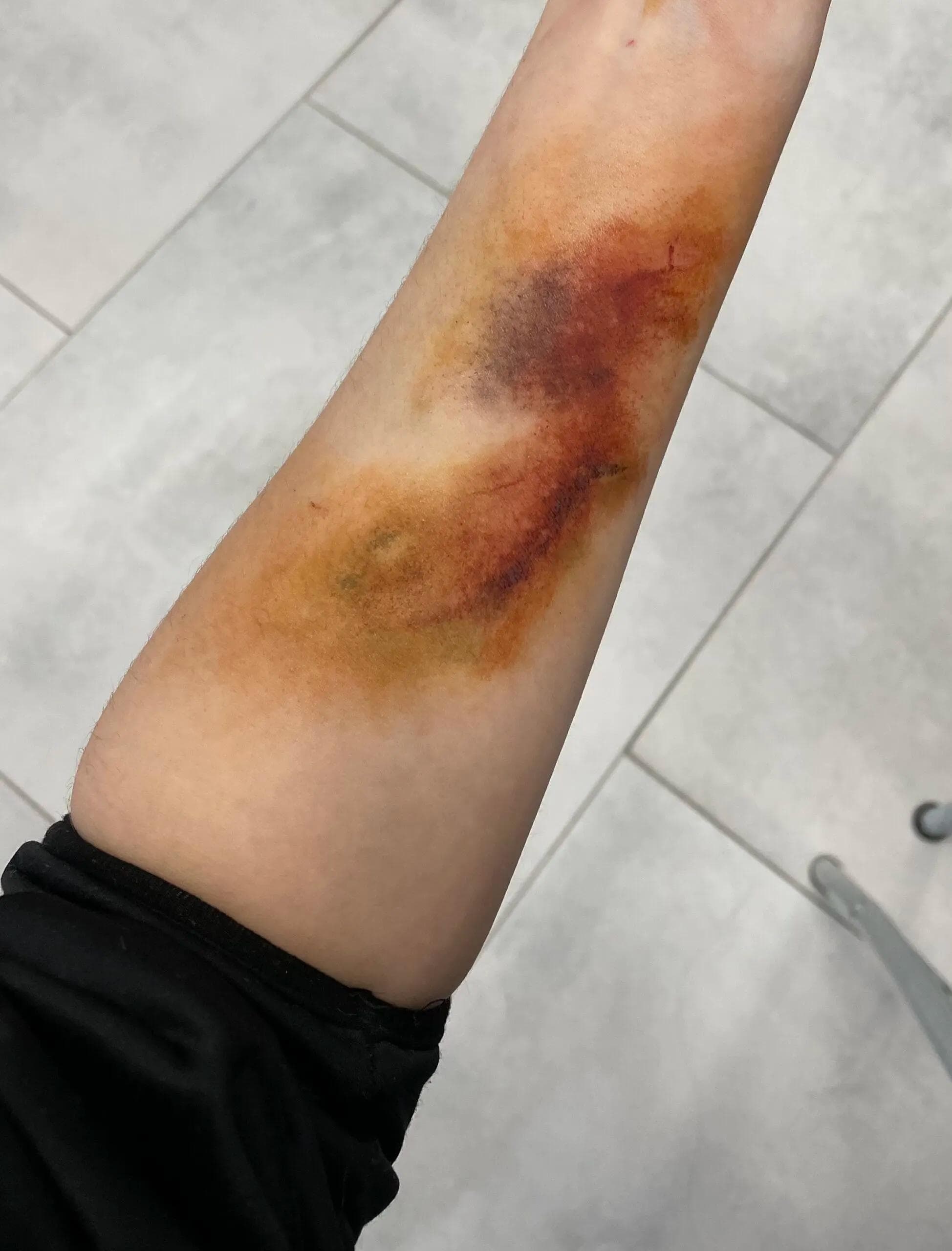 Charakteryzacja siniak